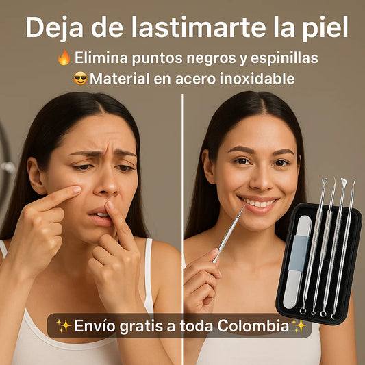 Kit para eliminar puntos negros I 7 piezas únicas -35% DE DESCUENTO
