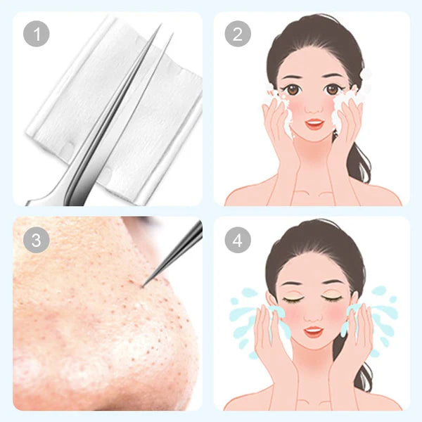 Kit para eliminar puntos negros I 7 piezas únicas -35% DE DESCUENTO