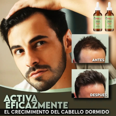 Aceite de Romero fortalecedor del cuero cabelludo-  OFERTA 2X1 HOY!