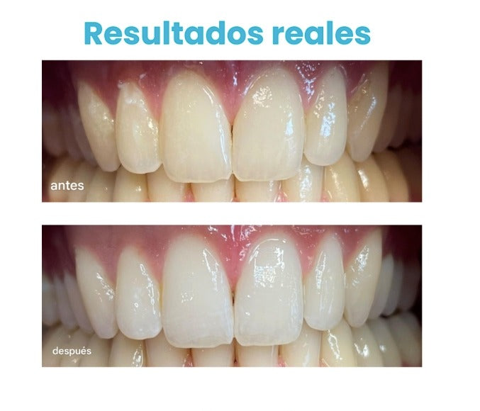 Encabezado