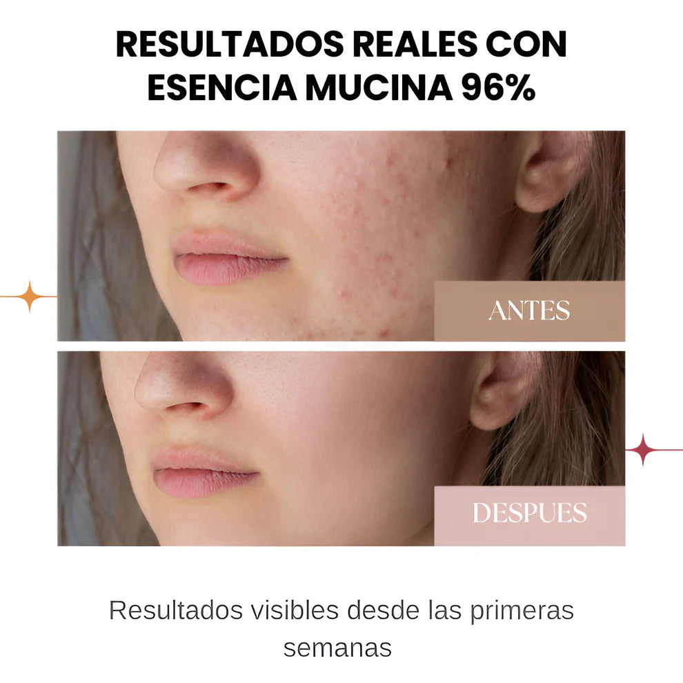 Baba de caracol I TU RUTINA DE SKINCARE -35% DE DESCUENTO