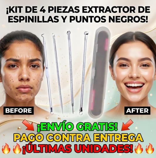 Kit 4 Piezas - Removedor de Espinillas